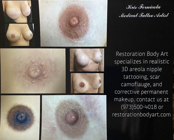 Restoration Body Art Realistic 3d Areola Nipple Tatooing